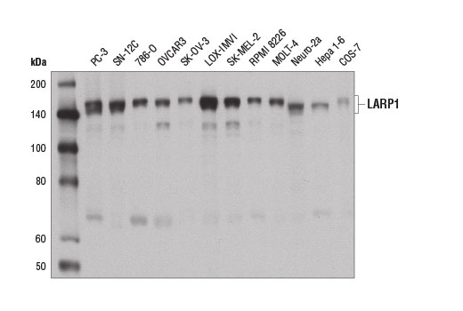 Western Blotting Image 1: LARP1 Antibody