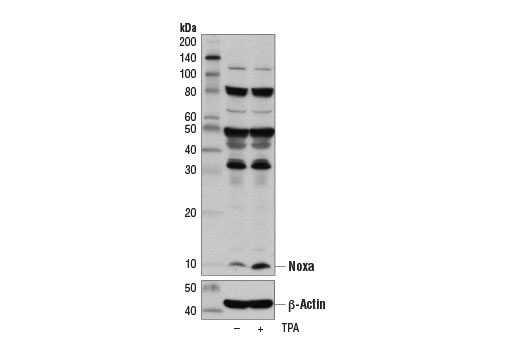  Image 19: Pro-Apoptosis Bcl-2 Family Antibody Sampler Kit II