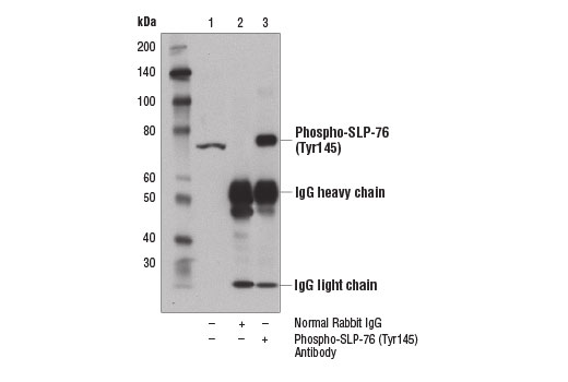 Immunoprecipitation Image 1: Phospho-SLP-76 (Tyr145) Antibody