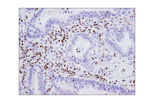 Immunohistochemistry Image 2: Ikaros (D6N9Y) Rabbit mAb (BSA and Azide Free)