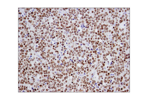 Immunohistochemistry Image 1: Ikaros (D6N9Y) Rabbit mAb (BSA and Azide Free)