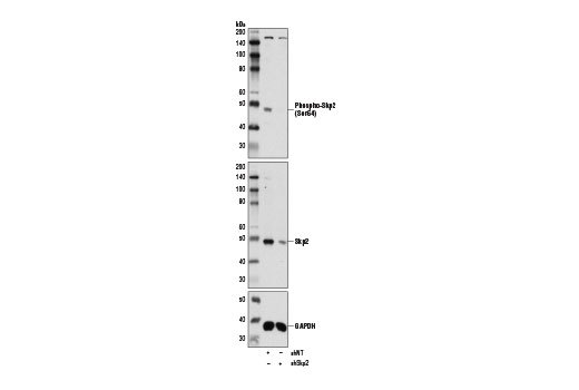 Western Blotting Image 1: Phospho-Skp2 (Ser64) Antibody