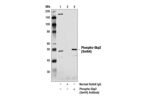 Immunoprecipitation Image 1: Phospho-Skp2 (Ser64) Antibody