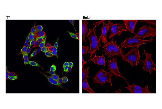 Immunofluorescence Image 2: CGRP (D5R8F) Rabbit mAb