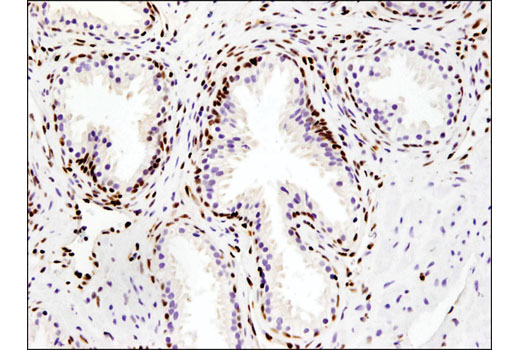 Immunohistochemistry Image 4: IFI16 (D8B5T) Rabbit mAb