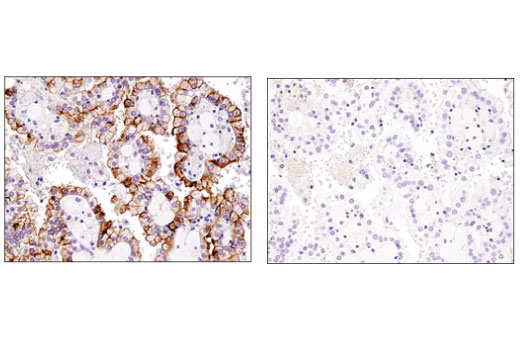 Immunohistochemistry Image 4: TIM-1 (E1R9N) Rabbit mAb (BSA and Azide Free)