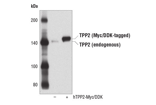 Western Blotting Image 1: TPP2 Antibody