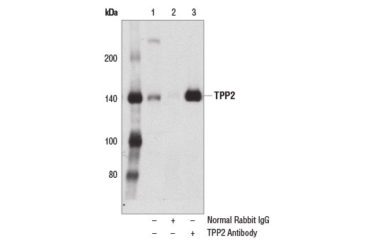Immunoprecipitation Image 1: TPP2 Antibody