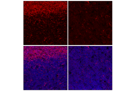 Immunofluorescence Image 1: Stat1 (D4Y6Z) Rabbit mAb