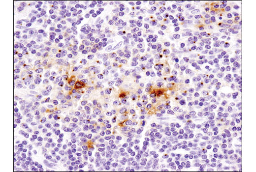 Immunohistochemistry Image 1: CD40 Ligand (D5J9Y) Rabbit mAb