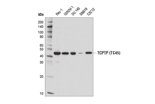 Western Blotting Image 1: TCPTP (TC45) Antibody