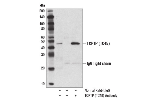 Immunoprecipitation Image 1: TCPTP (TC45) Antibody