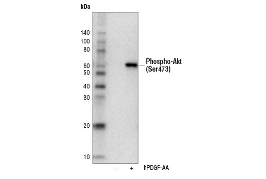 Western Blotting Image 1: Phospho-Akt (Ser473) (D9W9U) Mouse mAb (Biotinylated)
