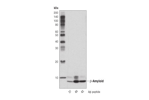 Western Blotting Image 1: β-Amyloid (D3D2N) Mouse mAb