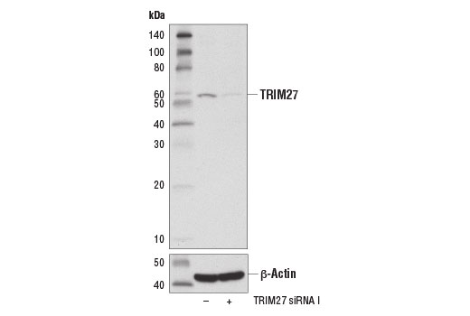  Image 1: SignalSilence® TRIM27 siRNA I