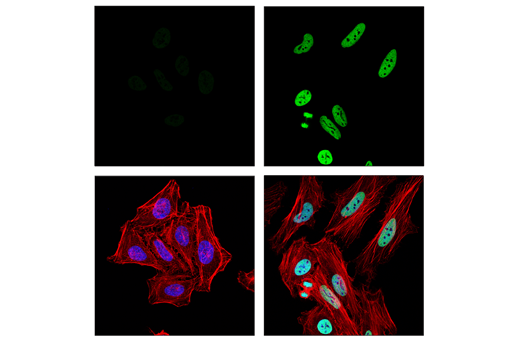 Immunofluorescence Image 1: Acetyl-Histone H3 (Lys27) (D5E4) XP® Rabbit mAb (Alexa Fluor® 488 Conjugate)