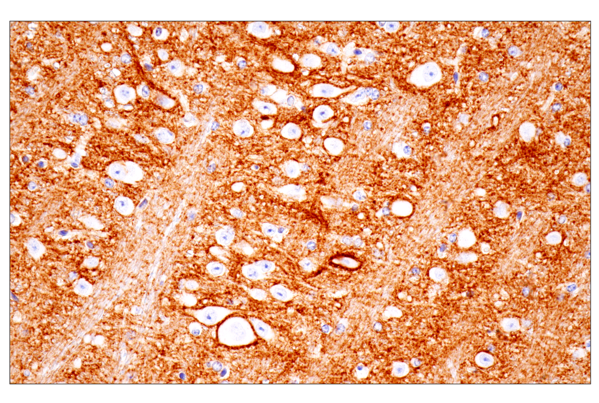 Immunohistochemistry Image 8: PTPRZ1 (E7C8Z) Rabbit mAb