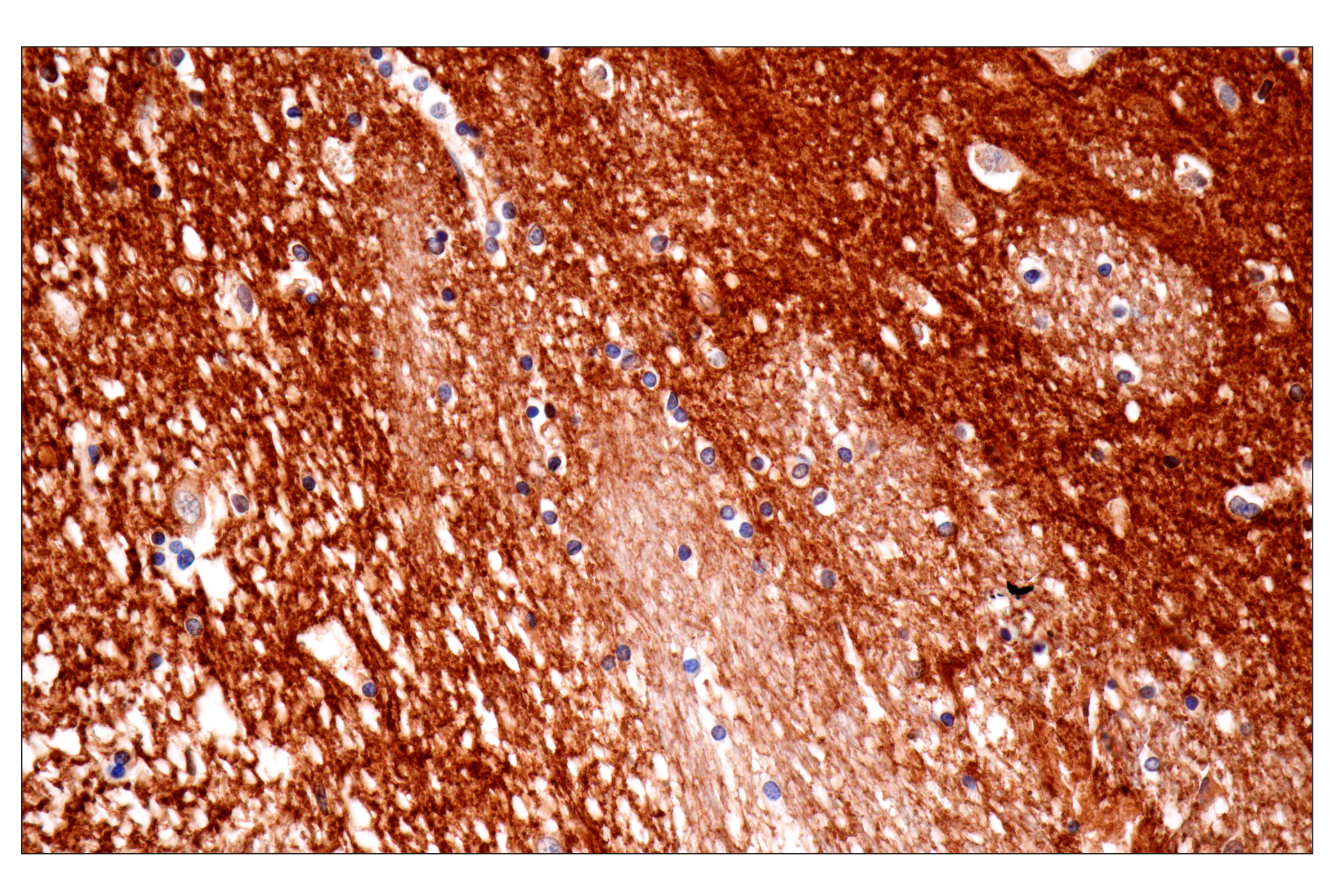 Immunohistochemistry Image 2: PTPRZ1 (E7C8Z) Rabbit mAb