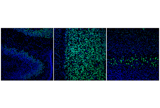 Immunofluorescence Image 1: Bcl-11B (D6F1) XP® Rabbit mAb (BSA and Azide Free)