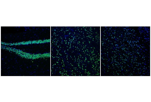 Immunofluorescence Image 2: Bcl-11B (D6F1) XP® Rabbit mAb (BSA and Azide Free)
