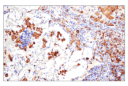  Image 21: Mouse Reactive Alzheimer's Disease Model Microglia Phenotyping IF Antibody Sampler Kit
