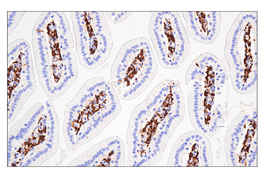  Image 57: Mouse Reactive Alzheimer's Disease Model Microglia Phenotyping IF Antibody Sampler Kit