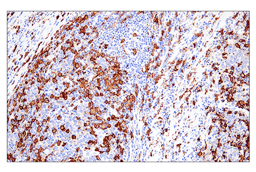  Image 88: Mouse Reactive M1 vs M2 Macrophage IHC Antibody Sampler Kit