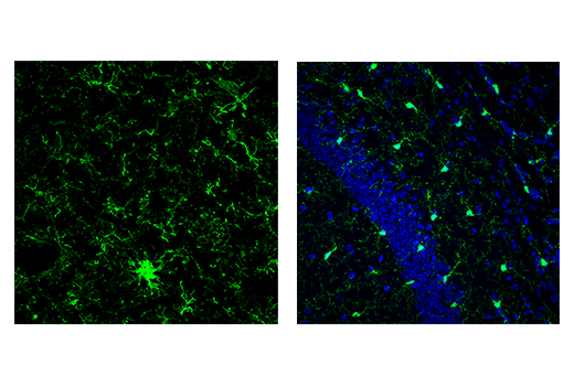  Image 64: Mouse Reactive Alzheimer's Disease Model Microglia Phenotyping IF Antibody Sampler Kit