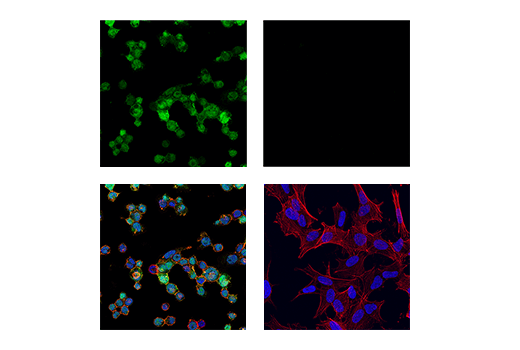 Immunofluorescence Image 5: Iba1/AIF-1 (E4O4W) XP® Rabbit mAb
