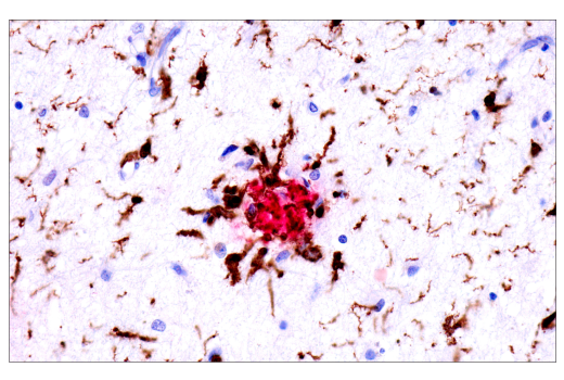  Image 42: Mouse Reactive Alzheimer's Disease Model Microglia Phenotyping IF Antibody Sampler Kit