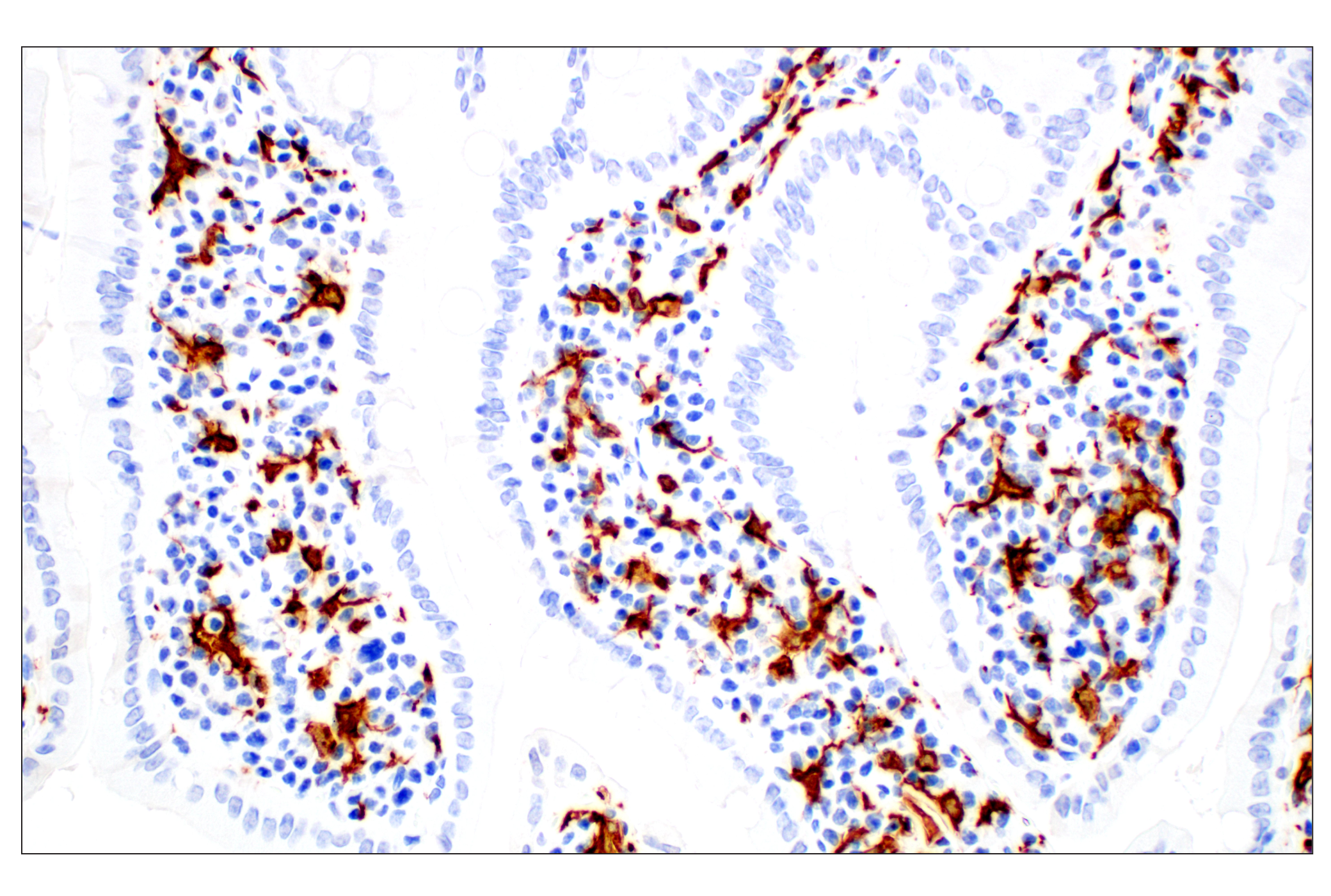  Image 62: Mouse Microglia Marker IF Antibody Sampler Kit