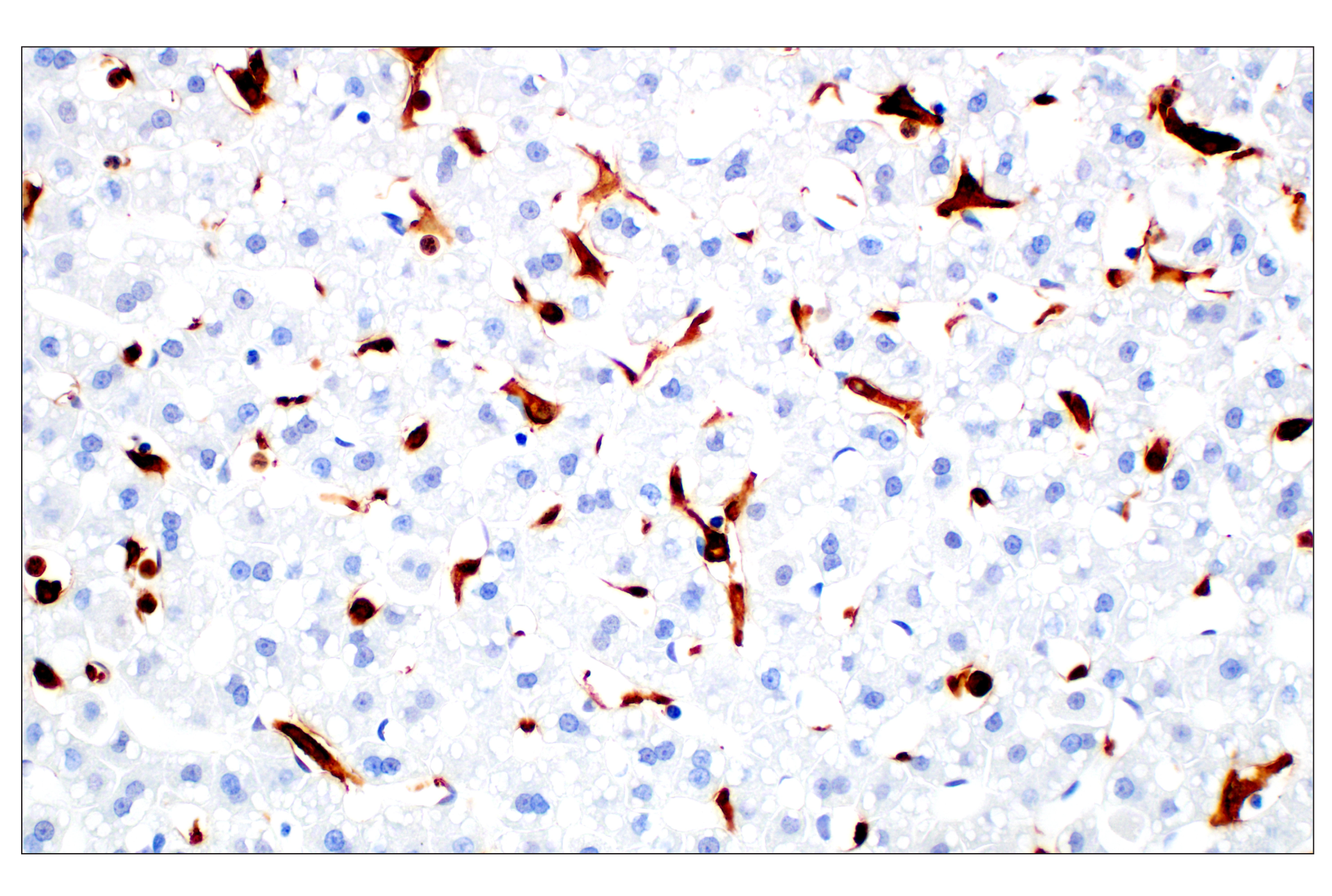  Image 58: Mouse Microglia Marker IF Antibody Sampler Kit