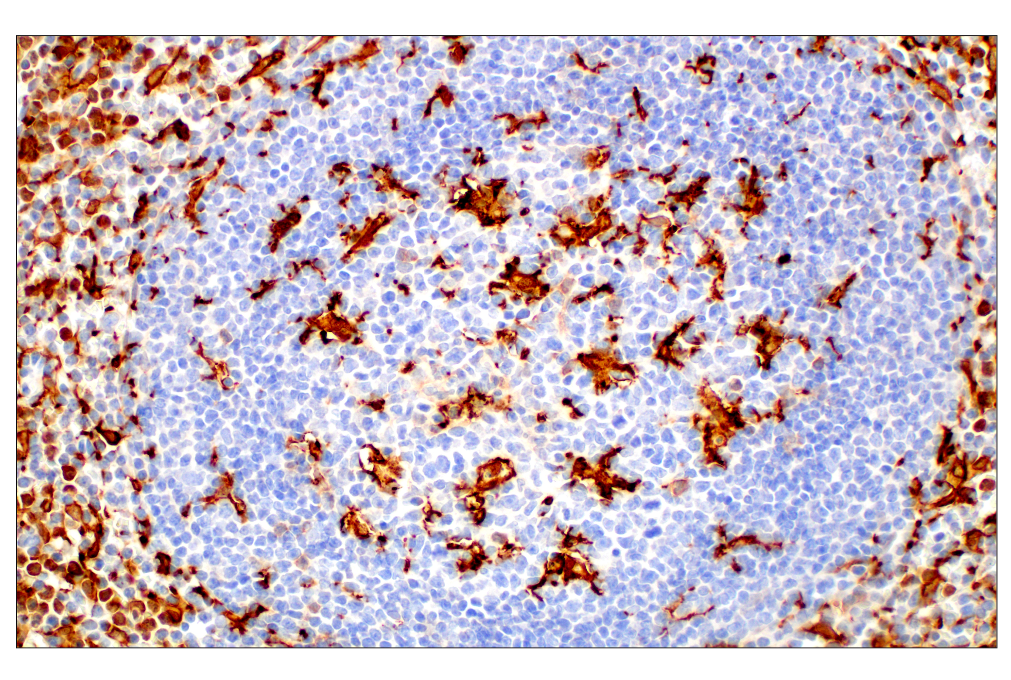  Image 70: Mouse Reactive M1 vs M2 Macrophage IHC Antibody Sampler Kit