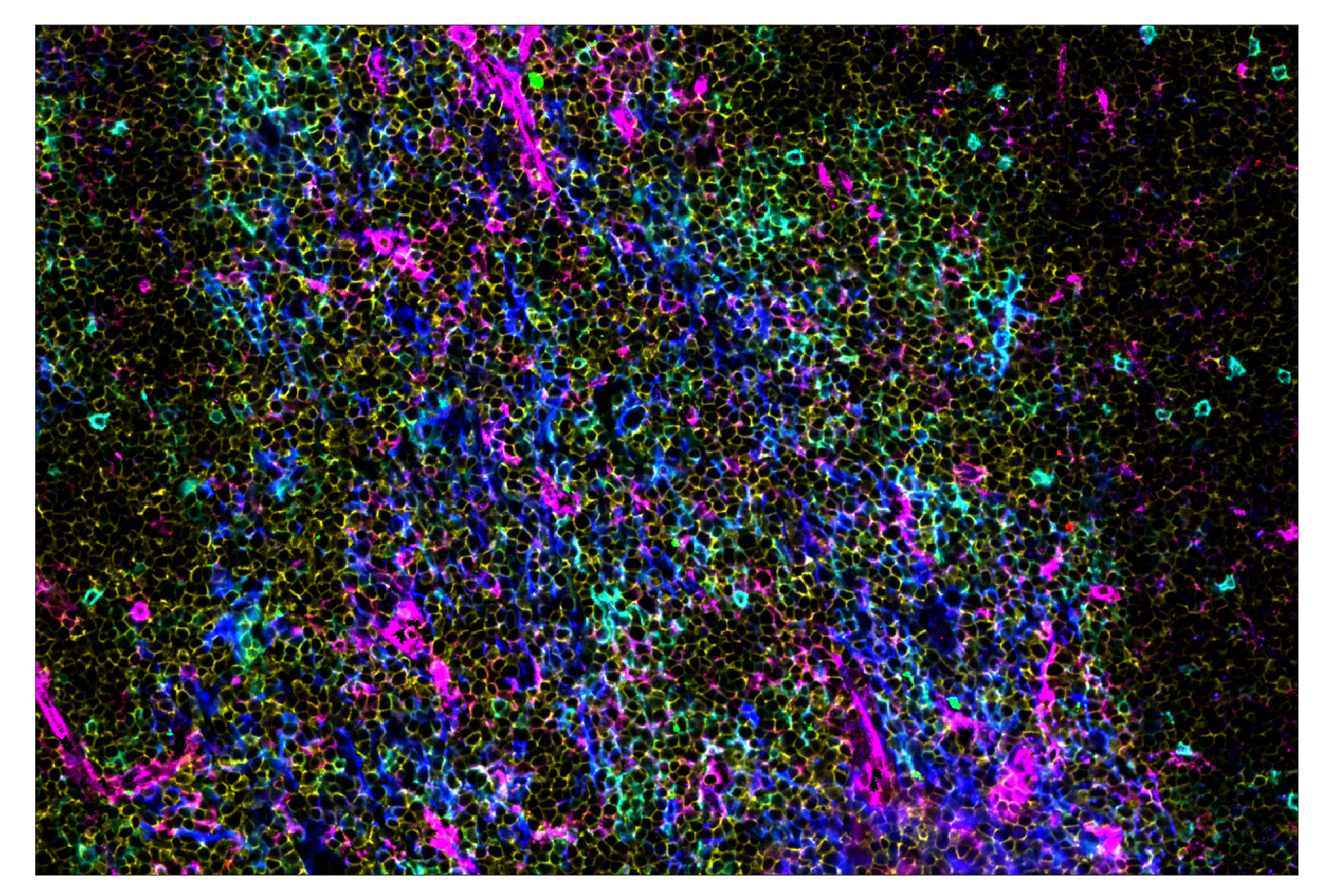 Immunohistochemistry Image 7: CD39/NTPDase 1 (E2X6B) & CO-0076-488 SignalStar™ Oligo-Antibody Pair