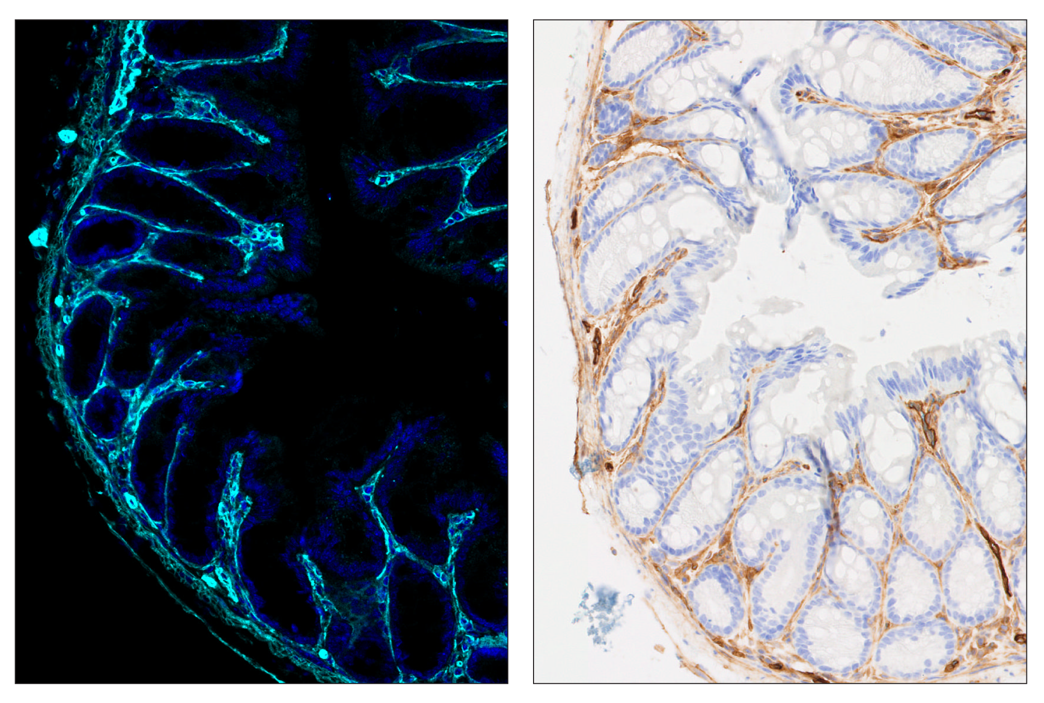 Immunohistochemistry Image 6: CD39/NTPDase 1 (E2X6B) & CO-0076-488 SignalStar™ Oligo-Antibody Pair