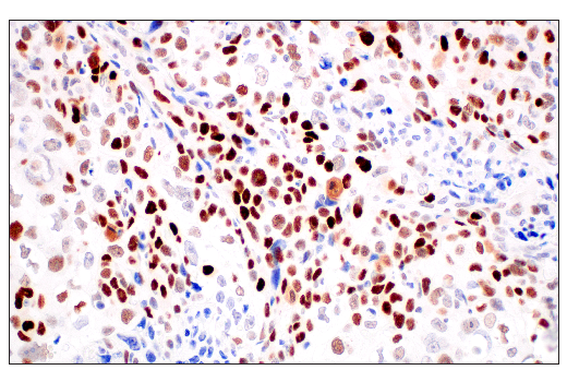 Immunohistochemistry Image 4: p53 (DO-1) Mouse mAb