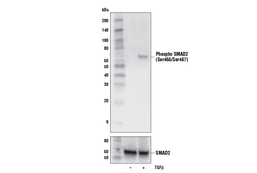  Image 1: PhosphoPlus® SMAD2 (Ser465/467) Antibody Duet