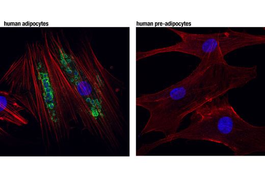 Immunofluorescence Image 2: HSL (D6W5S) XP® Rabbit mAb