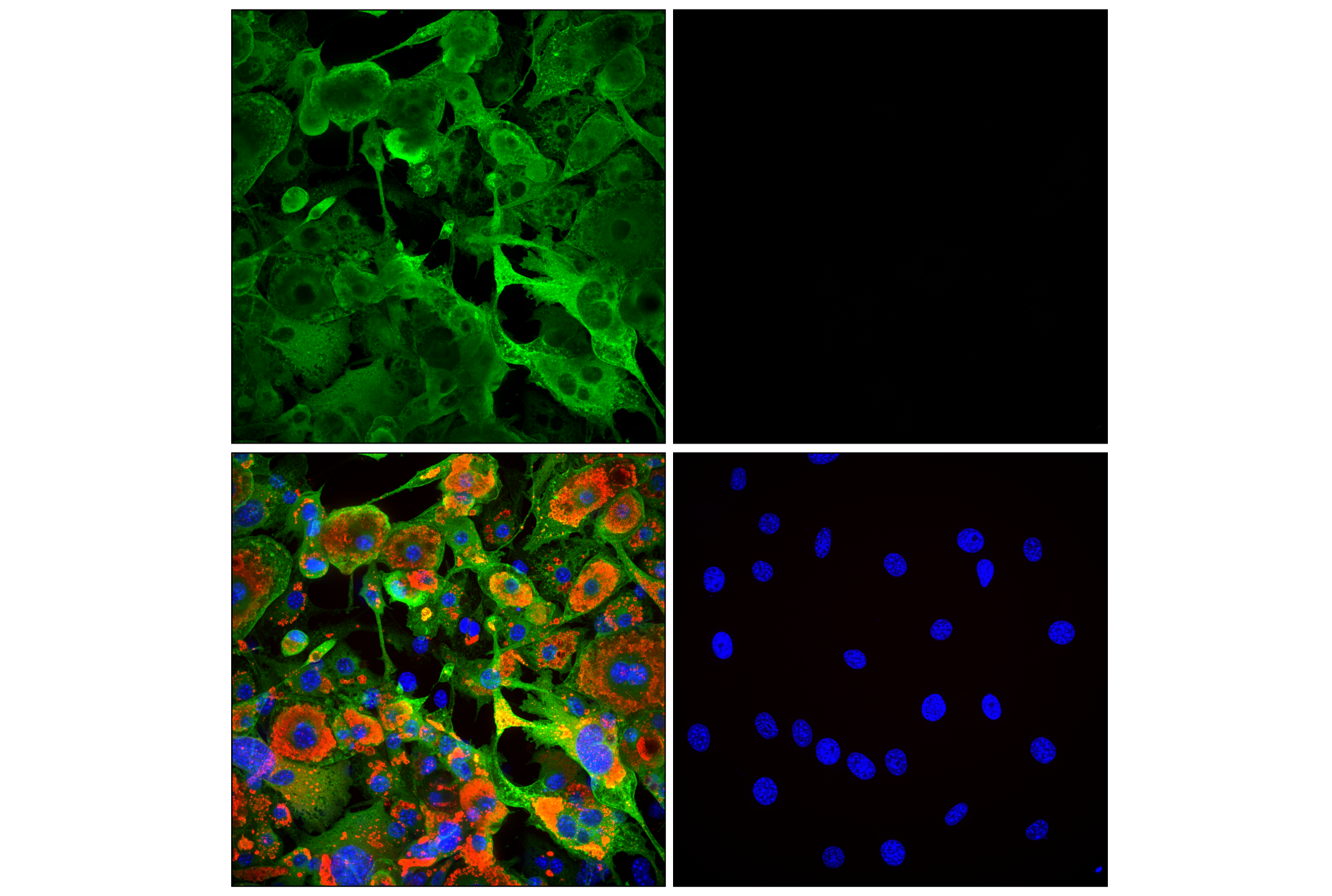 Immunofluorescence Image 1: HSL (D6W5S) XP® Rabbit mAb
