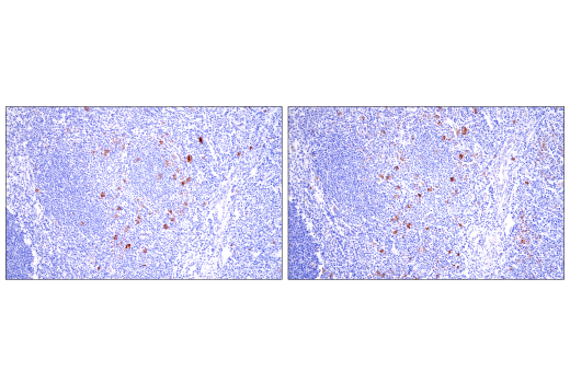 Immunohistochemistry Image 8: TNFRSF8/CD30 (E7E4D) XP® Rabbit mAb (BSA and Azide Free)