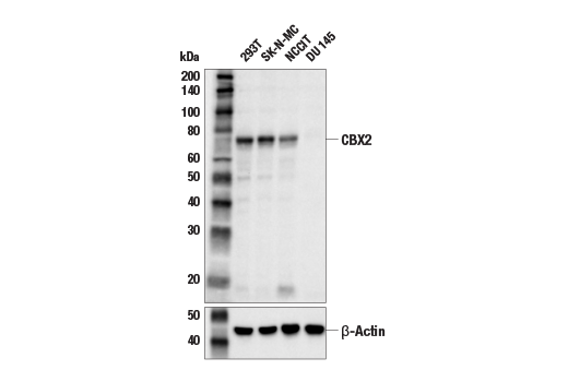 Western Blotting Image 1: CBX2 Antibody