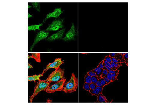 Immunofluorescence Image 1: p16 INK4A (E6N8P) Rabbit mAb