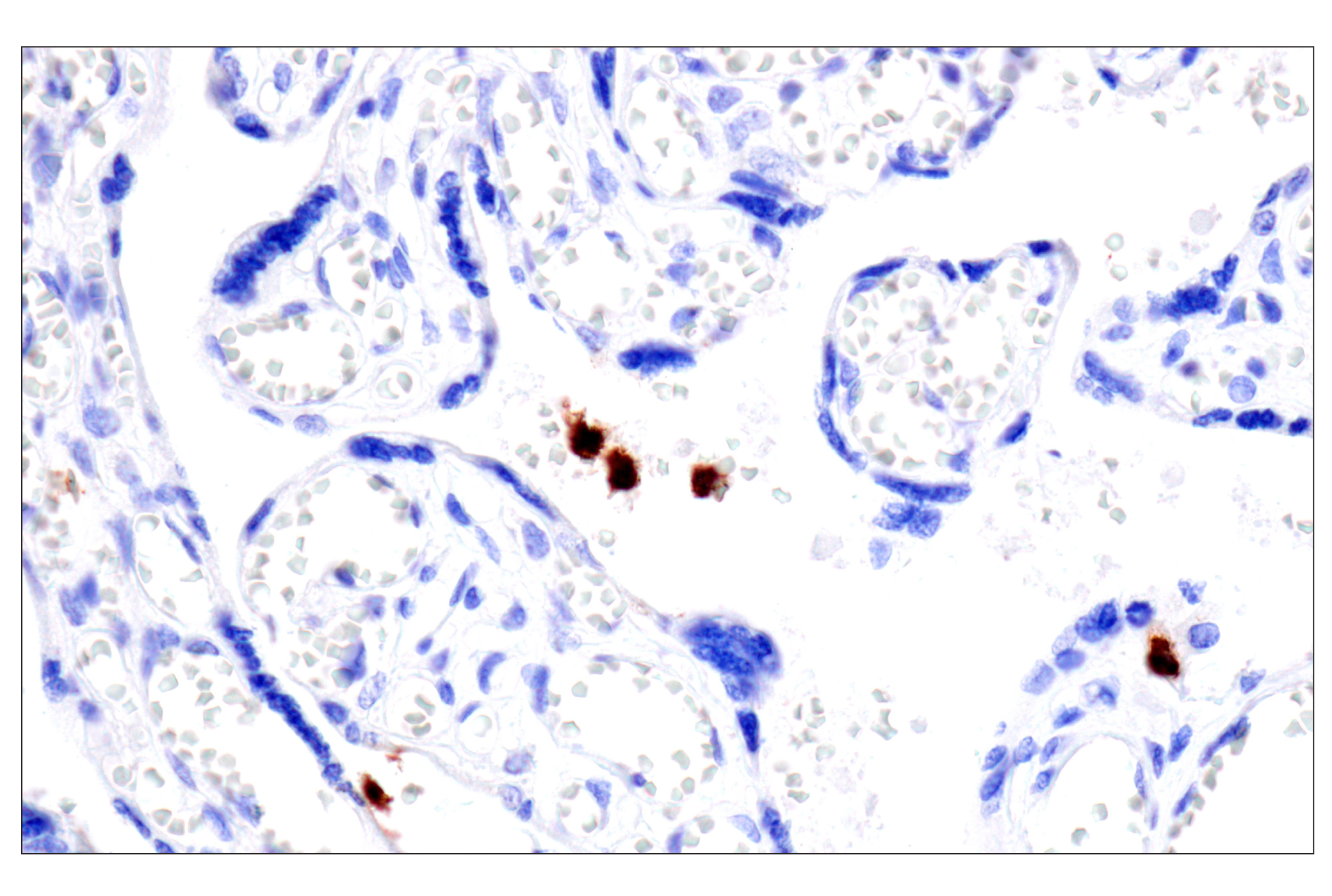 Immunohistochemistry Image 13: CD177 (F9O5U) Rabbit mAb