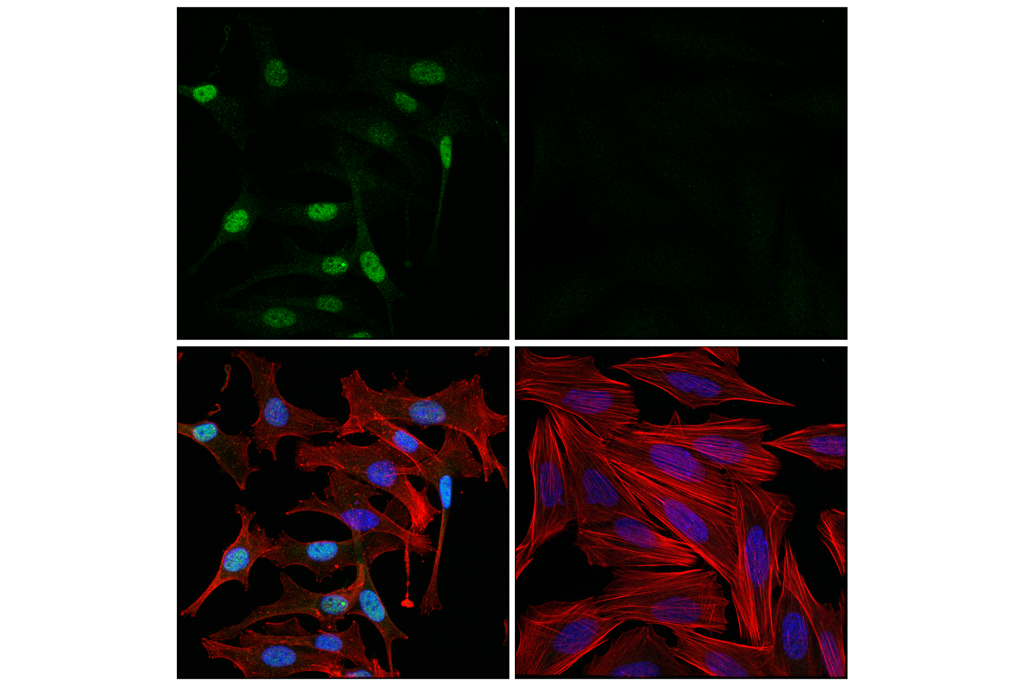 Immunofluorescence Image 1: ETV4 (E5Q1U) Rabbit mAb