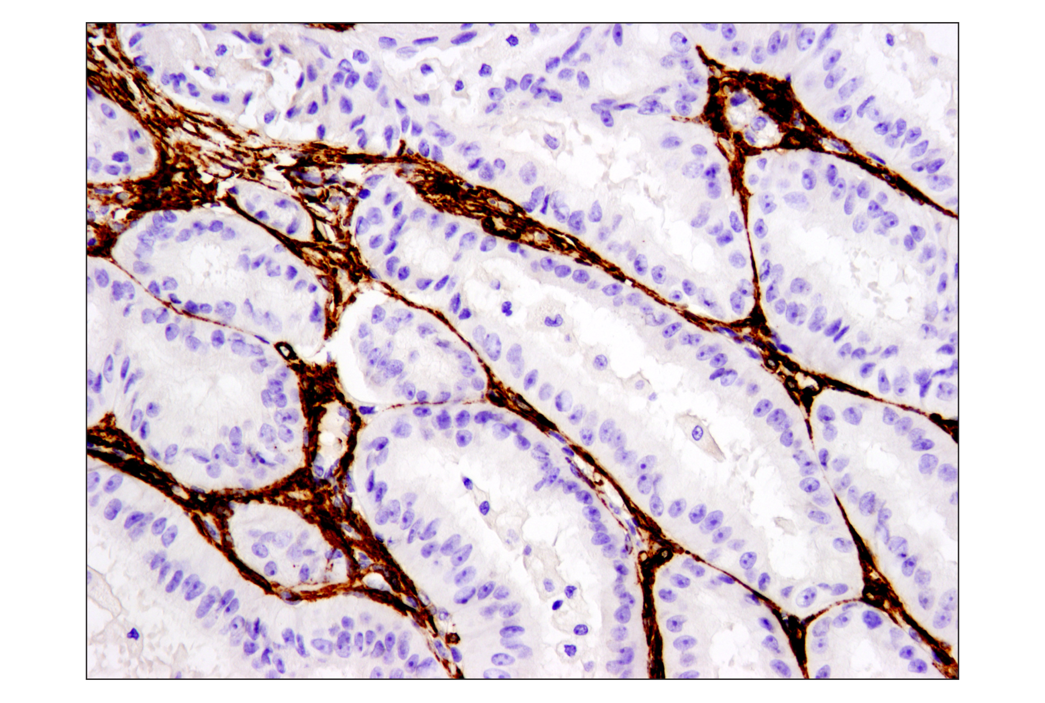  Image 5: TGF-β Fibrosis Pathway Antibody Sampler Kit