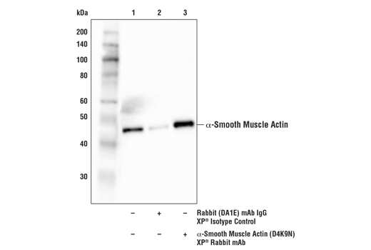  Image 16: TGF-β Fibrosis Pathway Antibody Sampler Kit