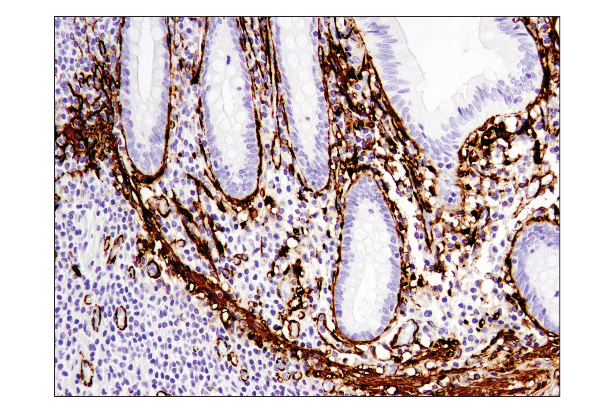  Image 17: TGF-β Fibrosis Pathway Antibody Sampler Kit