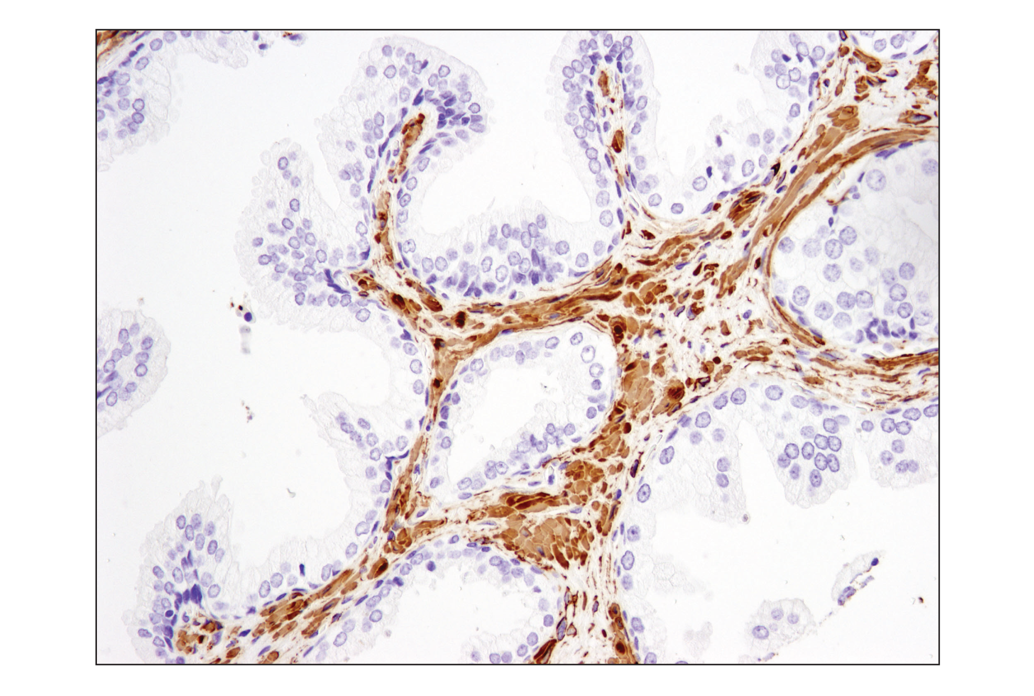  Image 38: TGF-β Fibrosis Pathway Antibody Sampler Kit