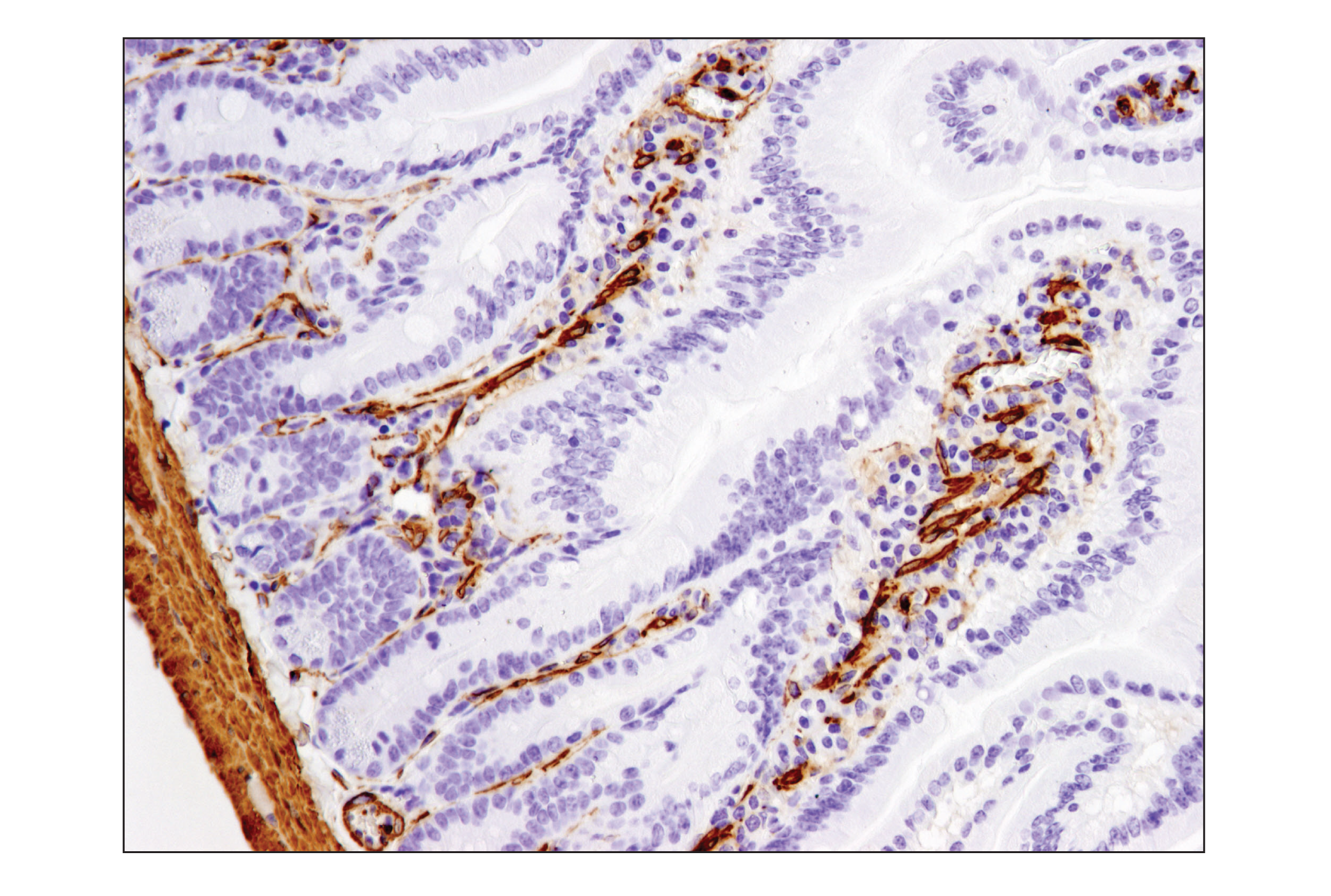  Image 42: TGF-β Fibrosis Pathway Antibody Sampler Kit