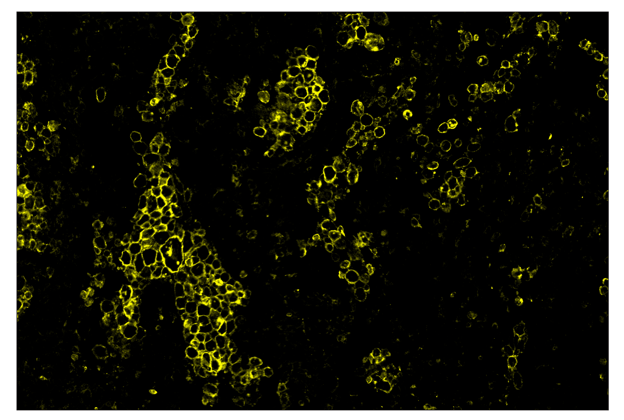 Immunohistochemistry Image 3: CD86 (E2G8P) & CO-0038-488 SignalStar™ Oligo-Antibody Pair